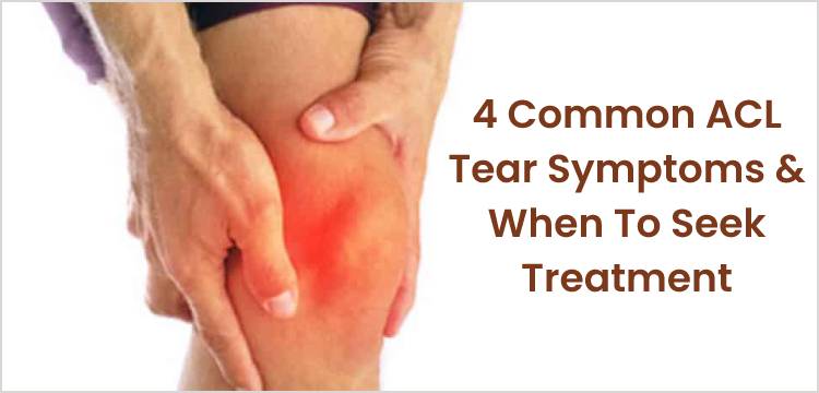  4 Common ACL Tear Symptoms & When To Seek Treatment